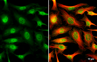 Anti-CDK6 antibody [N1C3] used in Immunocytochemistry/ Immunofluorescence (ICC/IF). GTX103992