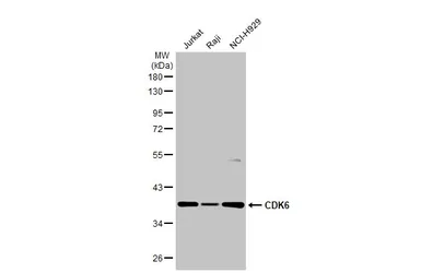 Anti-CDK6 antibody [N1C3] used in Western Blot (WB). GTX103992