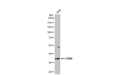 Anti-CDK6 antibody [N1C3] used in Western Blot (WB). GTX103992