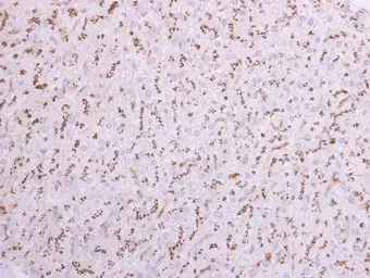 Anti-ST6GAL1 antibody [N2C3] used in IHC (Paraffin sections) (IHC-P). GTX104018