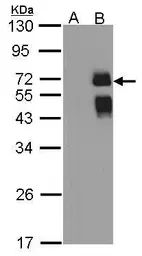 Anti-ST6GAL1 antibody [N2C3] used in Western Blot (WB). GTX104018