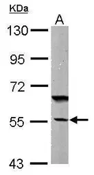 Anti-DNAJC7 antibody [N2C3] used in Western Blot (WB). GTX104079