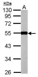 Anti-KLF12 antibody used in Western Blot (WB). GTX104232