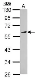 Anti-KLF12 antibody used in Western Blot (WB). GTX104232