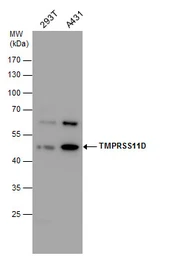 Anti-TMPRSS11D antibody used in Western Blot (WB). GTX104290