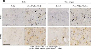 Anti-GPBB antibody used in IHC (Paraffin sections) (IHC-P). GTX104291