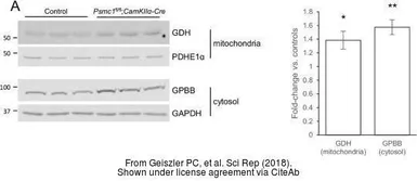 Anti-GPBB antibody used in Western Blot (WB). GTX104291