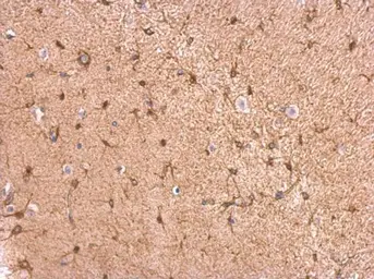 Anti-GPBB antibody used in IHC (Paraffin sections) (IHC-P). GTX104291