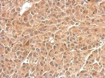 Anti-GPBB antibody used in IHC (Paraffin sections) (IHC-P). GTX104291