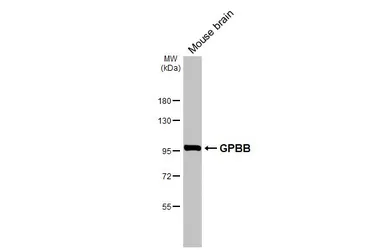 Anti-GPBB antibody used in Western Blot (WB). GTX104291