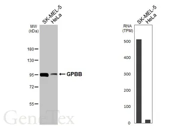 Anti-GPBB antibody used in Western Blot (WB). GTX104291