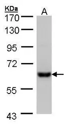 Anti-CES2 antibody used in Western Blot (WB). GTX104337