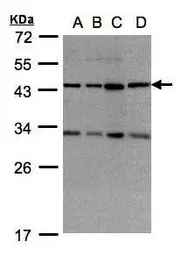 Anti-DNAJC17 antibody [N1C2] used in Western Blot (WB). GTX104456