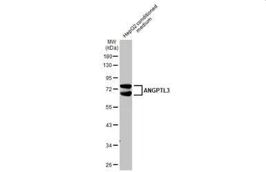 Anti-ANGPTL3 antibody used in Western Blot (WB). GTX104569