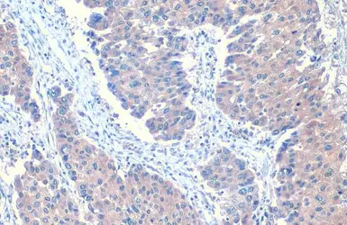 Anti-ANGPTL3 antibody used in IHC (Paraffin sections) (IHC-P). GTX104569