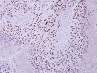 Anti-ZNF217 antibody [N3C2], Internal used in IHC (Paraffin sections) (IHC-P). GTX104572