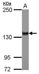 Anti-ZNF217 antibody [N3C2], Internal used in Western Blot (WB). GTX104572