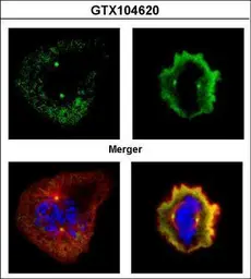 Anti-Aurora A antibody [C3], C-term used in Immunocytochemistry/ Immunofluorescence (ICC/IF). GTX104620