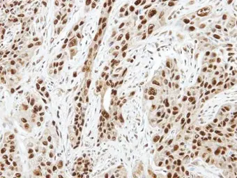 Anti-Aurora A antibody [C3], C-term used in IHC (Paraffin sections) (IHC-P). GTX104620