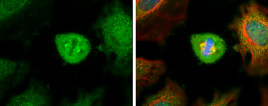 Anti-Aurora A antibody [C3], C-term used in Immunocytochemistry/ Immunofluorescence (ICC/IF). GTX104620