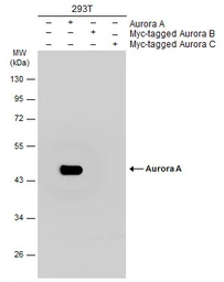 Anti-Aurora A antibody [C3], C-term used in Western Blot (WB). GTX104620