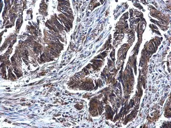 Anti-SDHB antibody [C2C3], C-term used in IHC (Paraffin sections) (IHC-P). GTX104628