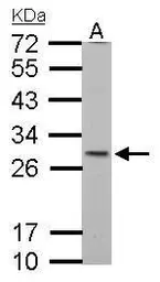 Anti-SDHB antibody [C2C3], C-term used in Western Blot (WB). GTX104628