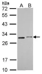 Anti-SDHB antibody [C2C3], C-term used in Western Blot (WB). GTX104628