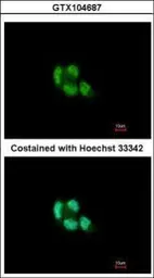 Anti-PSMB5 antibody [C2C3], C-term used in Immunocytochemistry/ Immunofluorescence (ICC/IF). GTX104687