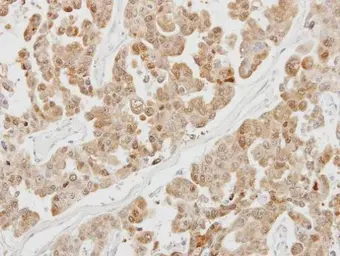 Anti-PSMB5 antibody [C2C3], C-term used in IHC (Paraffin sections) (IHC-P). GTX104687