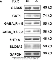 Anti-5-HT1A receptor antibody [N3C1], Internal used in Western Blot (WB). GTX104703