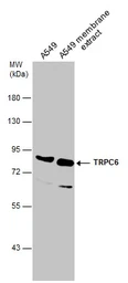 Anti-TRPC6 antibody [C3], C-term used in Western Blot (WB). GTX104730