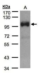 Anti-TRPC6 antibody [C3], C-term used in Western Blot (WB). GTX104730