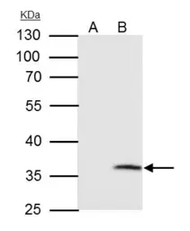 Anti-VDAC2 antibody [C2C3], C-term used in Immunoprecipitation (IP). GTX104745