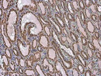 Anti-VDAC2 antibody [C2C3], C-term used in IHC (Paraffin sections) (IHC-P). GTX104745