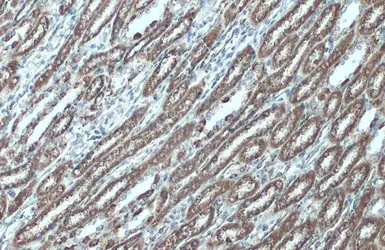 Anti-VDAC2 antibody [C2C3], C-term used in IHC (Paraffin sections) (IHC-P). GTX104745