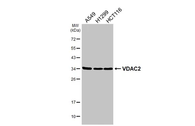 Anti-VDAC2 antibody [C2C3], C-term used in Western Blot (WB). GTX104745