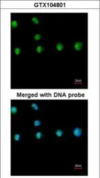 Anti-COUP TF1 antibody [N1], N-term used in Immunocytochemistry/ Immunofluorescence (ICC/IF). GTX104801