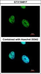 Anti-ATF7 antibody [C3], C-term used in Immunocytochemistry/ Immunofluorescence (ICC/IF). GTX104817