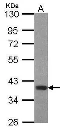 Anti-FOXB1 antibody [C2C3], C-term used in Western Blot (WB). GTX104844