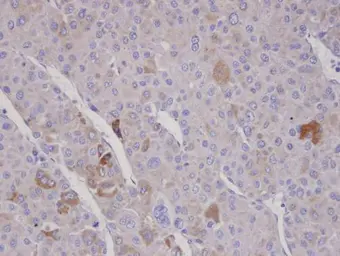 Anti-FBXO2 antibody [C2C3], C-term used in IHC (Paraffin sections) (IHC-P). GTX104858