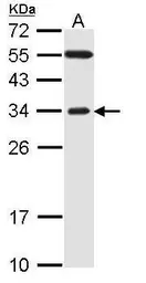 Anti-FBXO2 antibody [C2C3], C-term used in Western Blot (WB). GTX104858