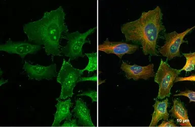 Anti-FBXL2 antibody [N1], N-term used in Immunocytochemistry/ Immunofluorescence (ICC/IF). GTX104864