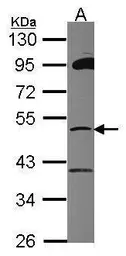 Anti-ZNF38 antibody [N2C2], Internal used in Western Blot (WB). GTX104915