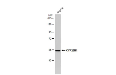 Anti-CYP26B1 antibody [N2C2], Internal used in Western Blot (WB). GTX104932