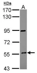 Anti-CYP4F12 antibody used in Western Blot (WB). GTX104951