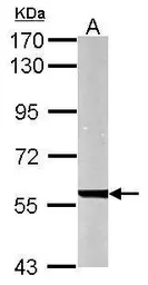 Anti-UGDH antibody used in Western Blot (WB). GTX104993