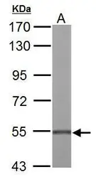 Anti-UGDH antibody used in Western Blot (WB). GTX104993