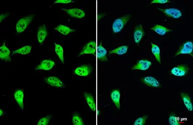 Anti-UGDH antibody used in Immunocytochemistry/ Immunofluorescence (ICC/IF). GTX104993