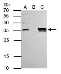 Anti-TFIIE beta antibody used in Immunoprecipitation (IP). GTX105029